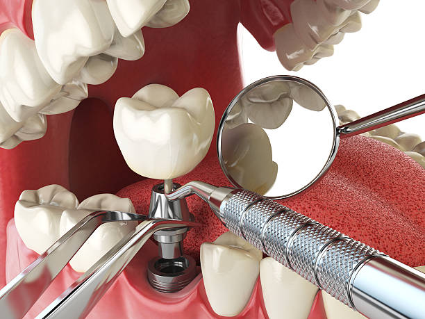 Best Urgent Dental Care for Toothache in Bolivar, WV